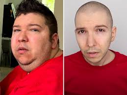 nick avocado nikocado nikocado avocado weight loss youtuber nikocado avocado nikocado avocado now ni
