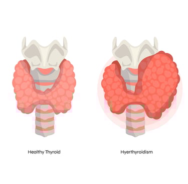 a diagram of the human organs of the stomach