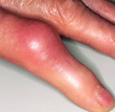 a person with a finger on a computer
