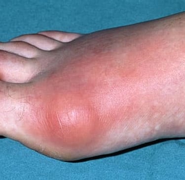 a person with a foot on a bed