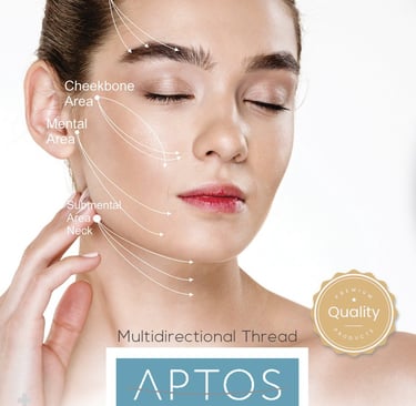 kenalan dengan benang aptos