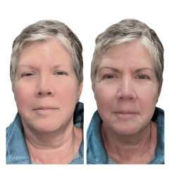 Healed microbladed brows designed to complement silver hair