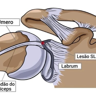 articolazione con lesione spalla