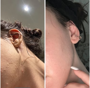 testimonial skin before and after