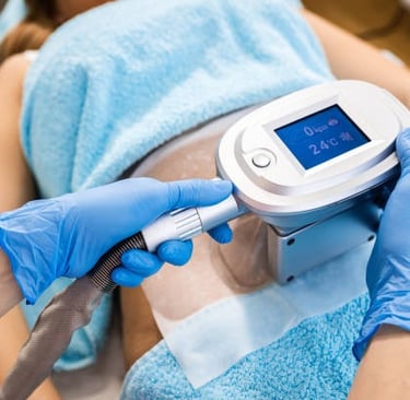 cryolipolyse