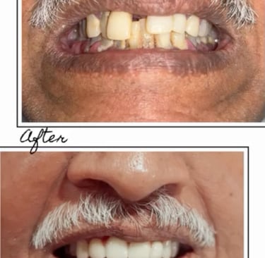 Dentist in Bangalore