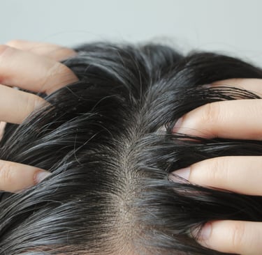 hair scalp image