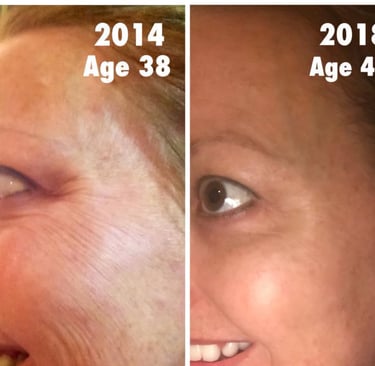 Skin peptides result