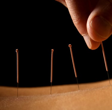 acupuncteur bernin au perchoir