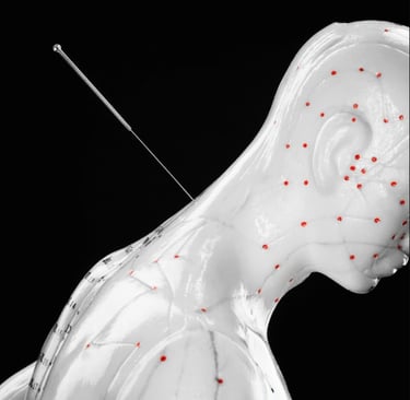 Points d'acupuncture sur Crolles et national Geographic