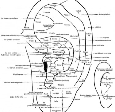auriculotherapie aide pour mincir acupuncteur crolles