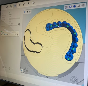 Diseño de todos nuestros casos de fija mediante CAD/CAM