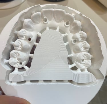 Fresado de estructuras y rehabilitación en Zirconios