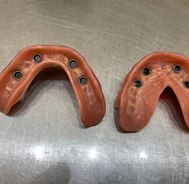 Sobredentadura sobre locators, all on 4