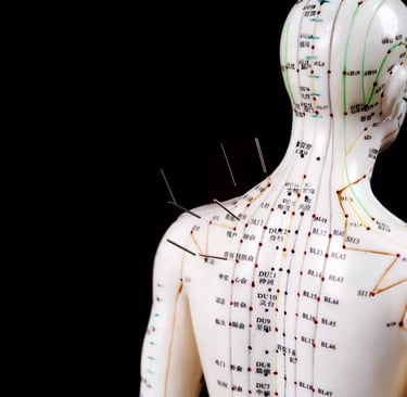 aiguilles acupuncture, médecine traditionnelle chinoise