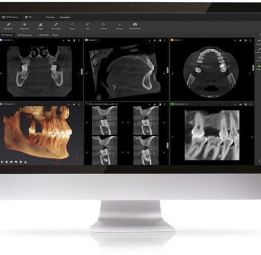Desktop monitor displaying 3D dental imaging software with CBCT scans and orthodontic X-rays.