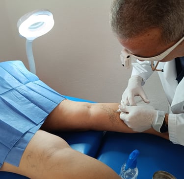 El Dr. Antonio Suárez realizando Escleroterapia con Espuma