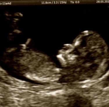 ultrasound image copyrighted