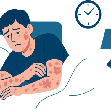 Psoriaas uni ja magamatus