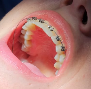 brackets metalicos badajoz