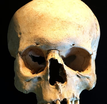 Asymmetry of the face