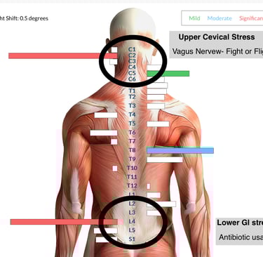 Neurological INSiGHT scans measuring nervous system stress linked to chronic ear infections in child