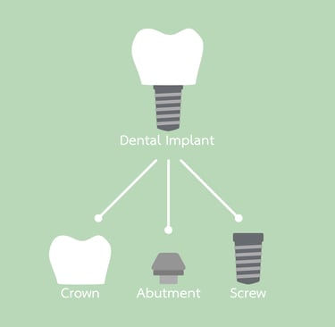 Dental implant pieces