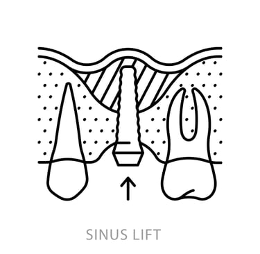 sinus lift
