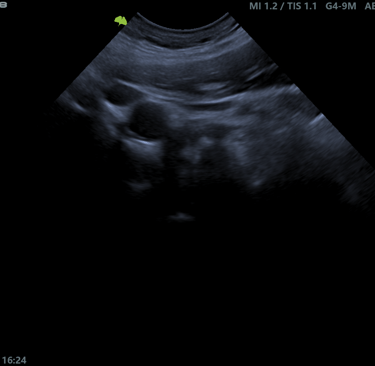 Imagen ecográfica abdominal veterinaria mostrando estructuras hepáticas y gástricas