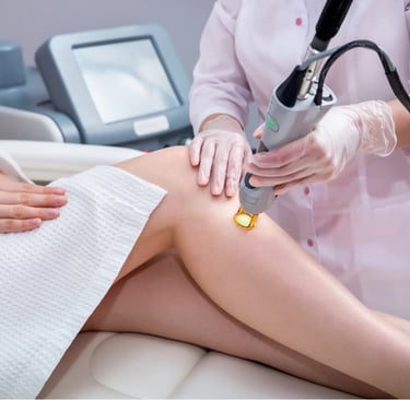 Lazer epilasyon sonrası dökülmeye başlayan tüyleri gösteren yakın plan kadın kolu