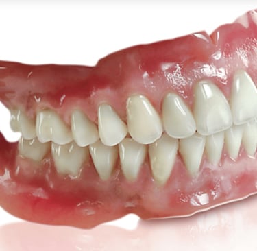 picture of complete dentures