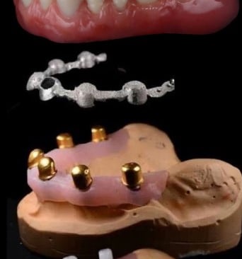 picture of a telescopic bridge