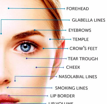 diagram of wrinkle lines