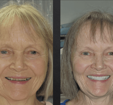 video of women's dental transformation