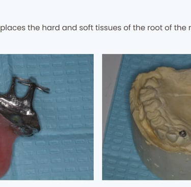 picture of an obturator