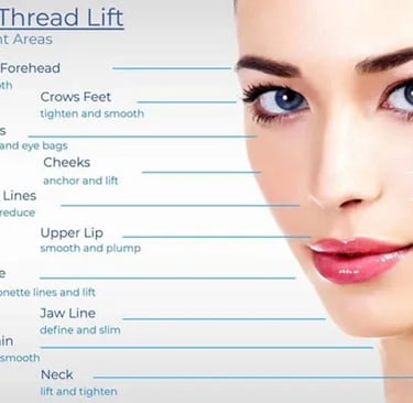 diagram of where PDO threads can be used on the face