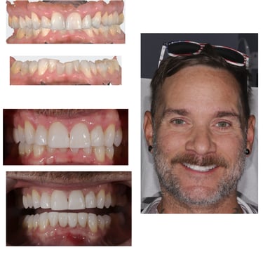 collage of man's smile