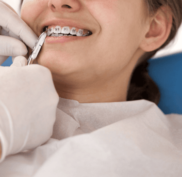 Benefits of early orthodontic treatment