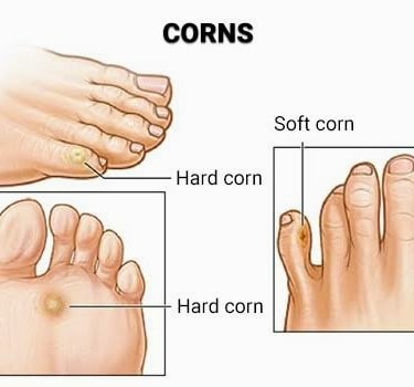 Vetrivel Health center best chiropractic and varamam theraphy 