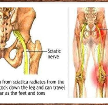 Vetrivel Health center best chiropractic and varamam theraphy 