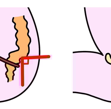 anorectal angle and puborectalis of the pelvic floor