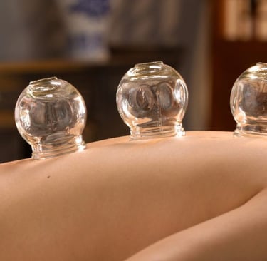 A practitioner performs fire cupping therapy with glass jars on a patient's back for muscle recovery.