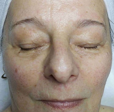 Neuro Cannabis kezelés eredménye veszprém