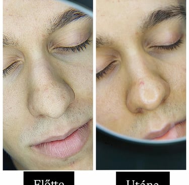 Férfi arckezelés Veszprém