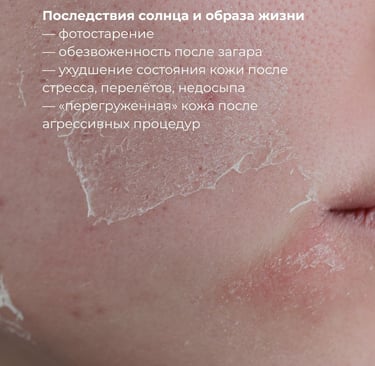 Борьба с фотостарением
