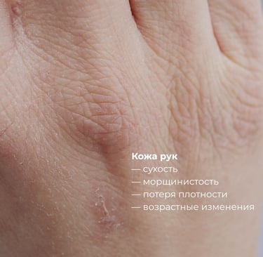 Глубокое увлаженение, выработка коллагена, сыворотка i-PRF насыщенная фибрином и факторами роста