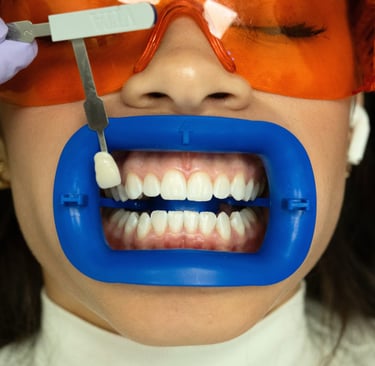 Professional teeth whitening treatment using a Zoom  in-office whitening system