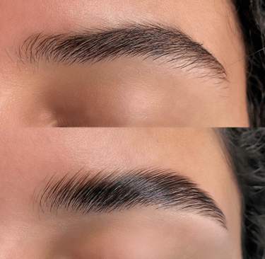 Browlift parfait debo beauty geneve