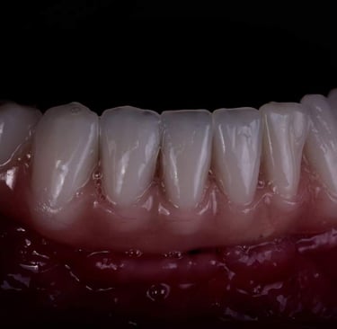 Prótese implantes cerâmica zirconia