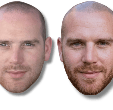 Before and after scalp micropigmentation results for a man with a shaved head and beard.